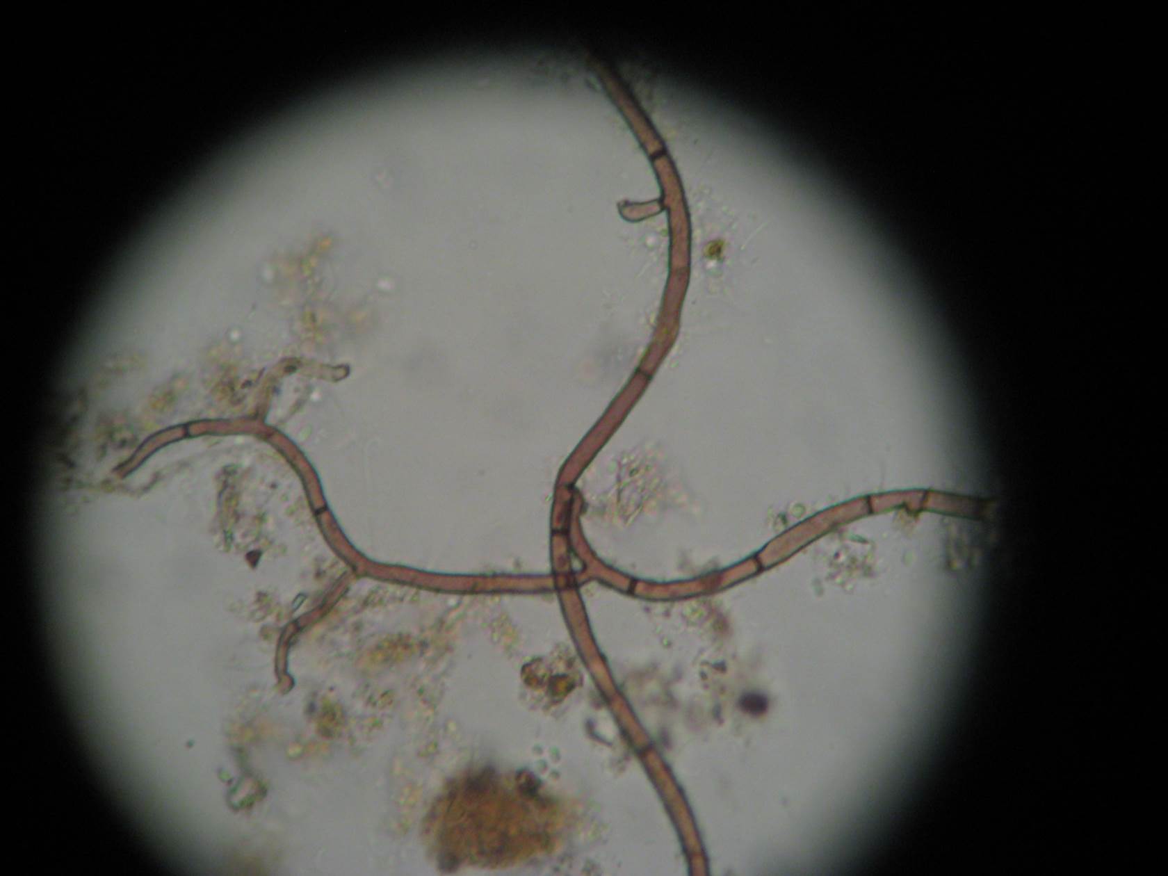 Beneficial Fungi Magnified 400X